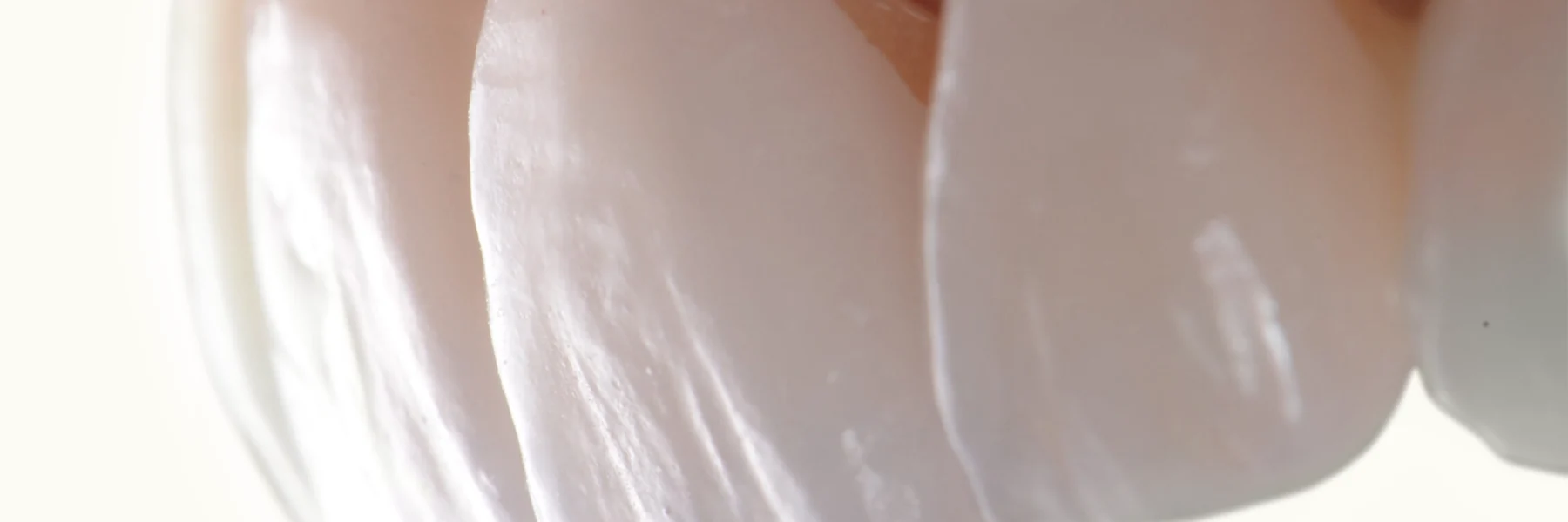 How to Choose the Best Clinic for Veneers in Abu Dhabi